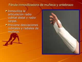 Férula inmovilizadora ddee mmuuññeeccaa yy aanntteebbrraazzoo 
IInnmmoovviilliizzaa llaa 
aarrttiiccuullaacciióónn rraaddiioo 
ccuubbiittaall ddiissttaall yy rraaddiioo 
ccaarrppaall.. 
PPrreevviieennee ddeessvviiaacciioonneess 
ccuubbiittaalleess yy rraaddiiaalleess ddee 
mmuuññeeccaa.. 
 