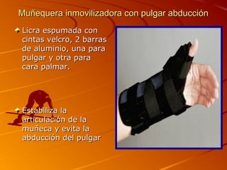 Muñequera inmovilizadora ccoonn ppuullggaarr aabbdduucccciióónn 
LLiiccrraa eessppuummaaddaa ccoonn 
cciinnttaass vveellccrroo,, 22 bbaarrrraass 
ddee aalluummiinniioo,, uunnaa ppaarraa 
ppuullggaarr yy oottrraa ppaarraa 
ccaarraa ppaallmmaarr.. 
EEssttaabbiilliizzaa llaa 
aarrttiiccuullaacciióónn ddee llaa 
mmuuññeeccaa yy eevviittaa llaa 
aabbdduucccciióónn ddeell ppuullggaarr 
 