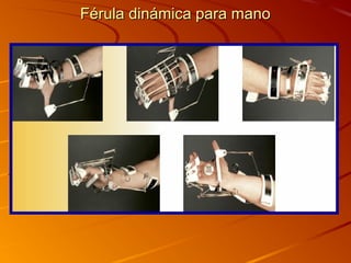 FFéérruullaa ddiinnáámmiiccaa ppaarraa mmaannoo 
 