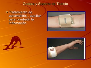 CCooddeerraa yy SSooppoorrttee ddee TTeenniissttaa 
TTrraattaammiieennttoo ddee 
eeppiiccoonnddiilliittiiss ,, aauuxxiilliiaarr 
ppaarraa ccoommbbaattiirr llaa 
iinnffllaammaacciióónn.. 
 