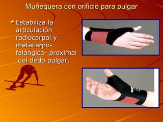 Muñequera ccoonn oorriiffiicciioo ppaarraa ppuullggaarr 
EEssttaabbiilliizzaa llaa 
aarrttiiccuullaacciióónn 
rraaddiiooccaarrppaall yy 
mmeettaaccaarrppoo-- 
ffaalláánnggiiccaa-- pprrooxxiimmaall 
ddeell ddeeddoo ppuullggaarr.. 
 