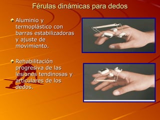 FFéérruullaass ddiinnáámmiiccaass ppaarraa ddeeddooss 
AAlluummiinniioo yy 
tteerrmmoopplláássttiiccoo ccoonn 
bbaarrrraass eessttaabbiilliizzaaddoorraass 
yy aajjuussttee ddee 
mmoovviimmiieennttoo.. 
RReehhaabbiilliittaacciióónn 
pprrooggrreessiivvaa ddee llaass 
lleessiioonneess tteennddiinnoossaass yy 
aarrttiiccuullaarreess ddee llooss 
ddeeddooss.. 
 