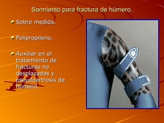 SSaarrmmiieennttoo ppaarraa ffrraaccttuurraa ddee hhúúmmeerroo.. 
SSoobbrree mmeeddiiddaa.. 
PPoolliipprrooppiilleennoo.. 
AAuuxxiilliiaarr eenn eell 
ttrraattaammiieennttoo ddee 
ffrraaccttuurraass nnoo 
ddeessppllaazzaaddaass yy 
ppsseeuuddooaarrttrroossiiss ddee 
hhúúmmeerroo.. 
 