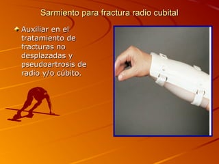 Sarmiento ppaarraa ffrraaccttuurraa rraaddiioo ccuubbiittaall 
AAuuxxiilliiaarr eenn eell 
ttrraattaammiieennttoo ddee 
ffrraaccttuurraass nnoo 
ddeessppllaazzaaddaass yy 
ppsseeuuddooaarrttrroossiiss ddee 
rraaddiioo yy//oo ccúúbbiittoo.. 
 