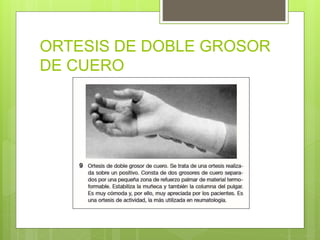 ORTESIS DE DOBLE GROSOR
DE CUERO
 