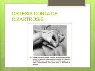 ORTESIS CORTA DE
RIZARTROSIS
 