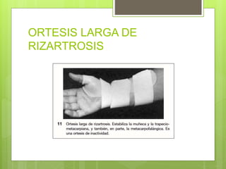 ORTESIS LARGA DE
RIZARTROSIS
 