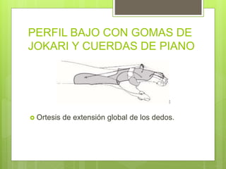 PERFIL BAJO CON GOMAS DE
JOKARI Y CUERDAS DE PIANO
 Ortesis de extensión global de los dedos.
 