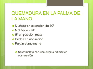 QUEMADURA EN LA PALMA DE
LA MANO
 Muñeca en extensión de 60º
 MC flexión 20º
 IF en posición recta
 Dedos en abducción
 Pulgar plano mano
 Se completa con una cúpula palmar en
compresión
 