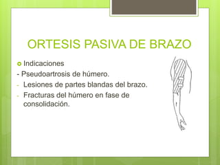 ORTESIS PASIVA DE BRAZO
 Indicaciones
- Pseudoartrosis de húmero.
- Lesiones de partes blandas del brazo.
- Fracturas del húmero en fase de
consolidación.
 