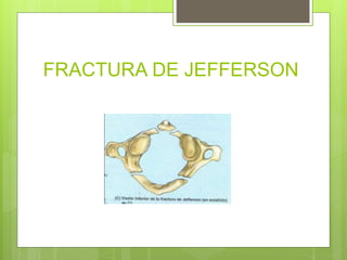 FRACTURA DE JEFFERSON
 