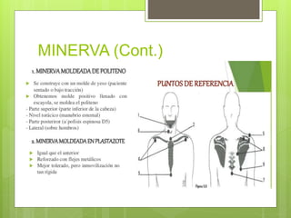 MINERVA (Cont.)
 