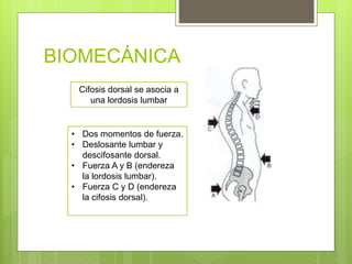 BIOMECÁNICA
Cifosis dorsal se asocia a
una lordosis lumbar
• Dos momentos de fuerza.
• Deslosante lumbar y
descifosante dorsal.
• Fuerza A y B (endereza
la lordosis lumbar).
• Fuerza C y D (endereza
la cifosis dorsal).
 
