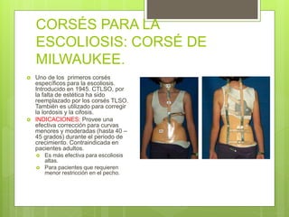 CORSÉS PARA LA
ESCOLIOSIS: CORSÉ DE
MILWAUKEE.
 Uno de los primeros corsés
específicos para la escoliosis.
Introducido en 1945. CTLSO, por
la falta de estética ha sido
reemplazado por los corsés TLSO.
También es utilizado para corregir
la lordosis y la cifosis.
 INDICACIONES: Provee una
efectiva corrección para curvas
menores y moderadas (hasta 40 –
45 grados) durante el periodo de
crecimiento. Contraindicada en
pacientes adultos.
 Es más efectiva para escoliosis
altas.
 Para pacientes que requieren
menor restricción en el pecho.
 