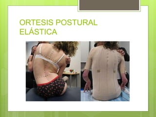 ORTESIS POSTURAL
ELÁSTICA
 