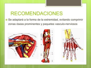 RECOMENDACIONES
 Se adaptará a la forma de la extremidad, evitando comprimir
zonas óseas prominentes y paquetes vasculo-nerviosos
 
