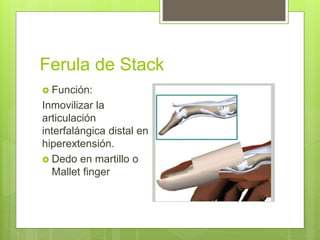 Ferula de Stack
 Función:
Inmovilizar la
articulación
interfalángica distal en
hiperextensión.
 Dedo en martillo o
Mallet finger
 