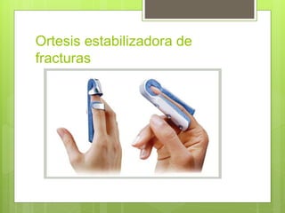 Ortesis estabilizadora de
fracturas
 