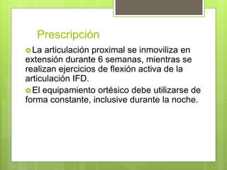 Prescripción
La articulación proximal se inmoviliza en
extensión durante 6 semanas, mientras se
realizan ejercicios de flexión activa de la
articulación IFD.
El equipamiento ortésico debe utilizarse de
forma constante, inclusive durante la noche.
 