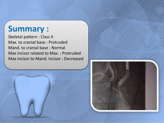 Summary : 
Skeletal pattern : Class II 
Max. to cranial base : Protruded 
Mand. to cranial base : Normal 
Max incisor related to Max. : Protruded 
Max incisor to Mand. Incisor : Decreased 
 