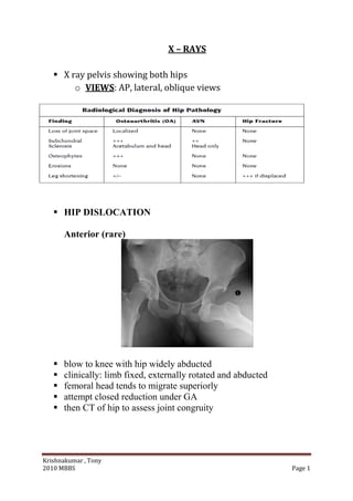 Krishnakumar , Tony
2010 MBBS Page 1
X – RAYS
 X ray pelvis showing both hips
o VIEWS: AP, lateral, oblique views
 HIP DISLOCATION
Anterior (rare)
 blow to knee with hip widely abducted
 clinically: limb fixed, externally rotated and abducted
 femoral head tends to migrate superiorly
 attempt closed reduction under GA
 then CT of hip to assess joint congruity
 