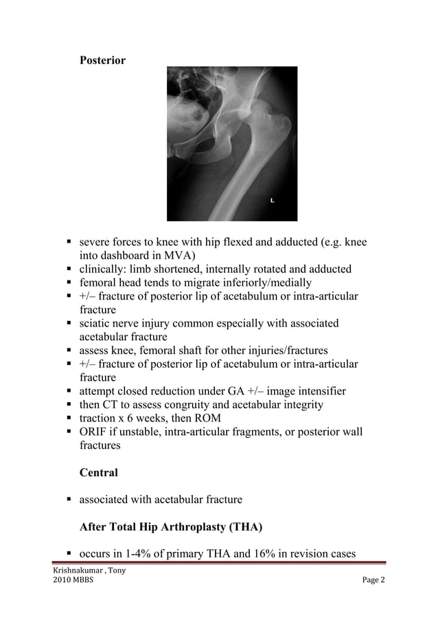 Ortho xray for mbbs students