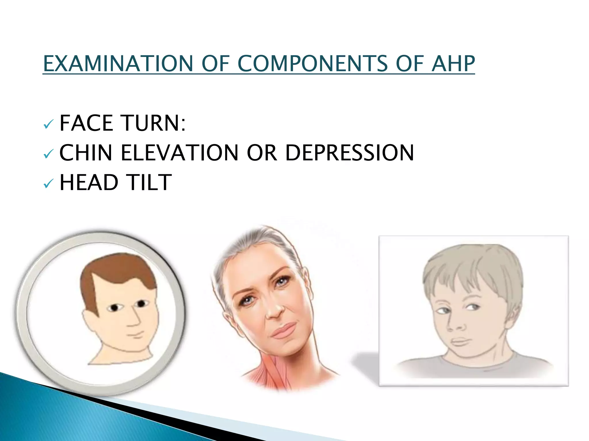 EXAMINATION OF COMPONENTS OF AHP
 FACE TURN:
 CHIN ELEVATION OR DEPRESSION
 HEAD TILT
 