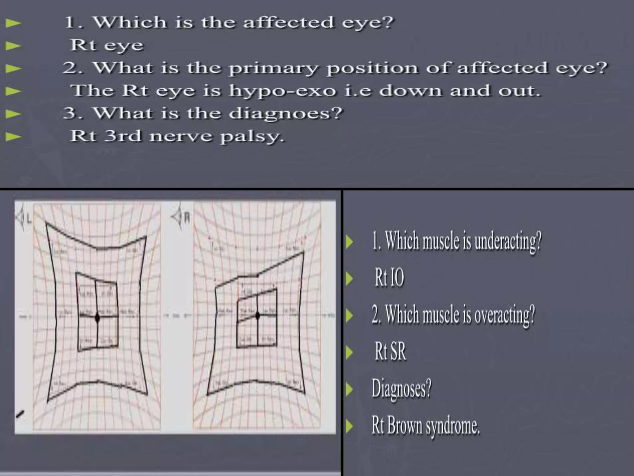 Concomitant and Incomitant, AHP and Hess chart