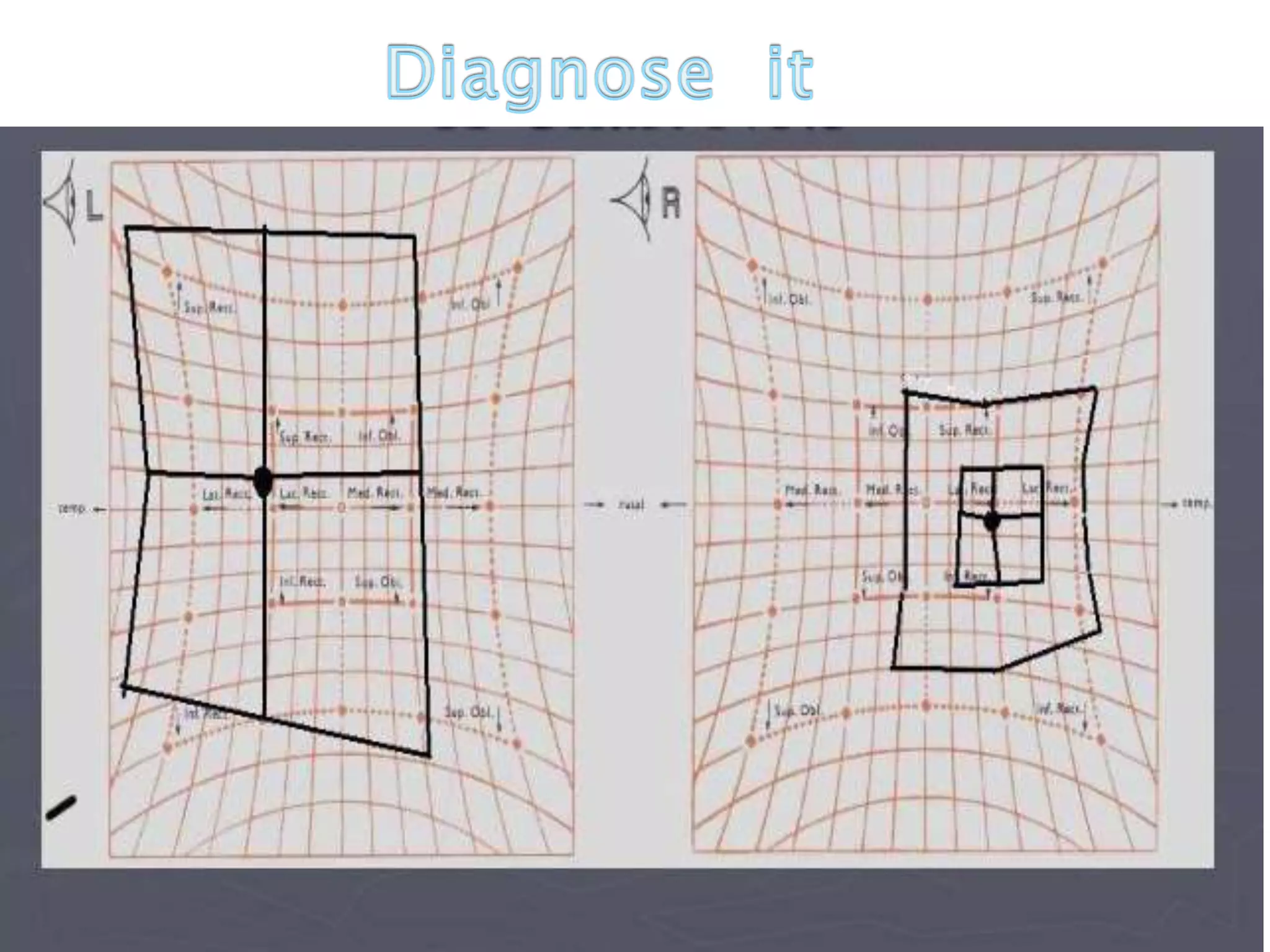 Concomitant and Incomitant, AHP and Hess chart
