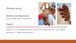Primarysurvey
Disability & neurological status:
GCS: E4V5M6, Pupils 3 mm RTLBE
Exposure:
Laceration wound at left mid foot dorsal side size 6 x 2 cm seen tendon tear and laceration
wound 5 x 1 cm , Laceration wound at 3rd and 5th toe left foot size 1 cm , 1 cm dorsalis
pedis pulse 2+ , tibialis posterior pulse 2+
 