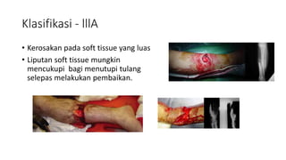 Klasifikasi - lllA
• Kerosakan pada soft tissue yang luas
• Liputan soft tissue mungkin
mencukupi bagi menutupi tulang
selepas melakukan pembaikan.
 