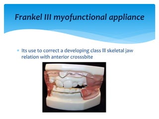  Its use to correct a developing class lll skeletal jaw
relation with anterior crosssbite
Frankel III myofunctional appliance
 