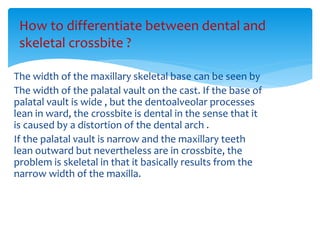 The width of the maxillary skeletal base can be seen by
The width of the palatal vault on the cast. If the base of
palatal vault is wide , but the dentoalveolar processes
lean in ward, the crossbite is dental in the sense that it
is caused by a distortion of the dental arch .
If the palatal vault is narrow and the maxillary teeth
lean outward but nevertheless are in crossbite, the
problem is skeletal in that it basically results from the
narrow width of the maxilla.
How to differentiate between dental and
skeletal crossbite ?
 