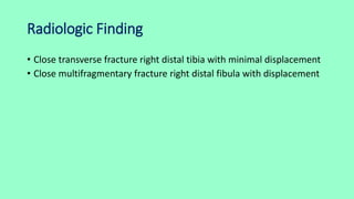 Radiologic Finding
• Close transverse fracture right distal tibia with minimal displacement
• Close multifragmentary fracture right distal fibula with displacement
 
