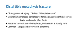 Distal tibia metaphysis fracture
• Often greenstick injury : “Robert Gillespie fracture”
• Mechanism : Increase compressive force along anterior tibial cortex
(axial load on dorsiflex foot)
• Posterior cortex is usually displaced, Periosteum is usually torn
• Common : valgus and recurvatum deformity
 