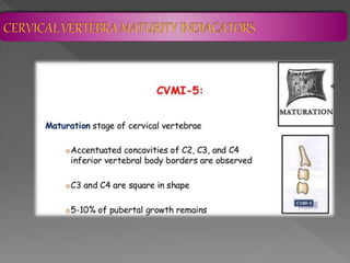 CERVICAL VERTEBRA MATURITY INDICATORS | PPTX