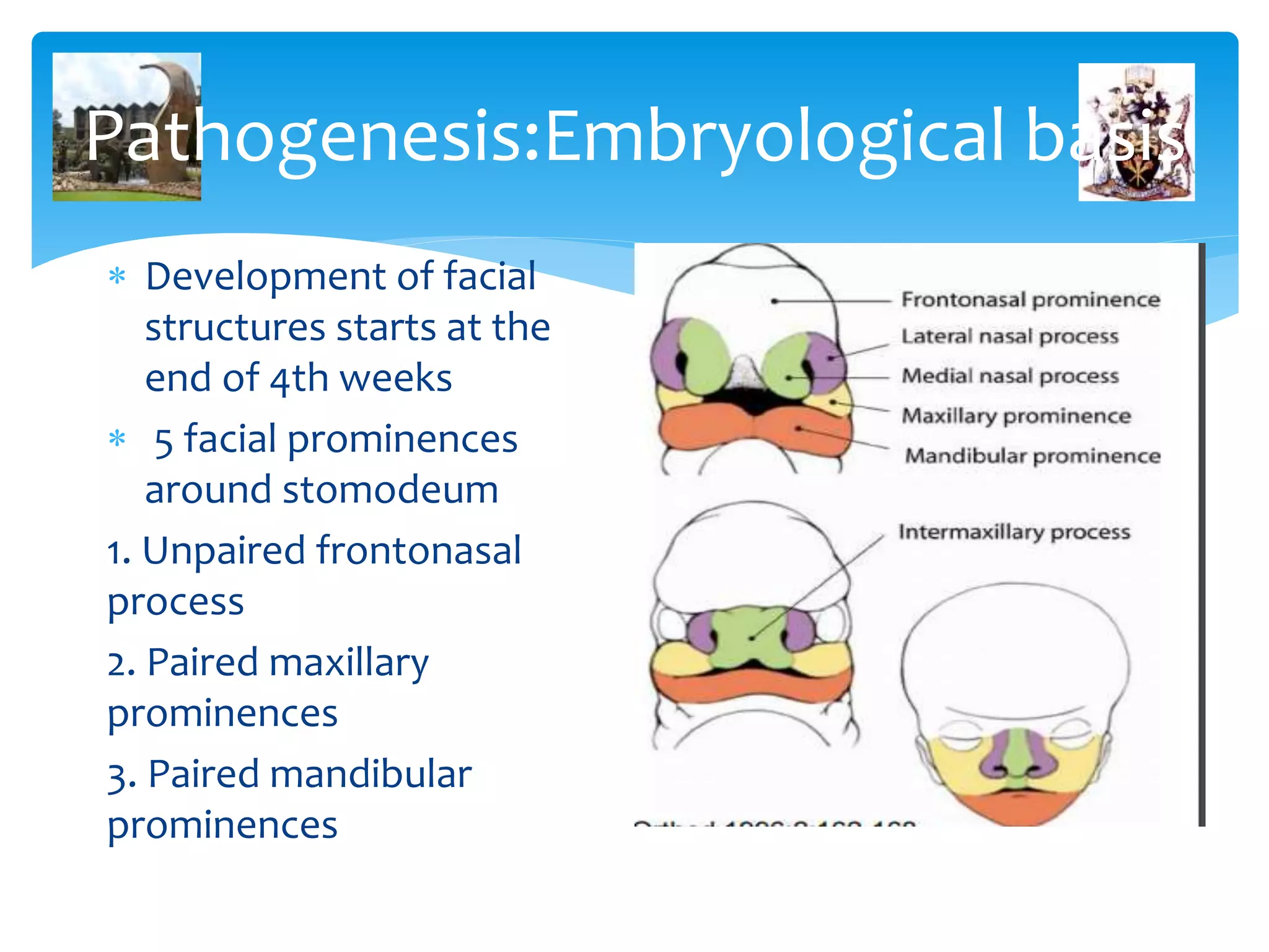 principles of Orthodontic management of cleft lip and palate | PPT