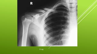 Xgp Radiopaedia orthopaedics surgery by dr shubham patel | PPTX