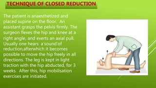 orthopaedics surgery by dr shubham patel | PPTX