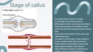 ortho - fracture healing with stages and complications | PPTX