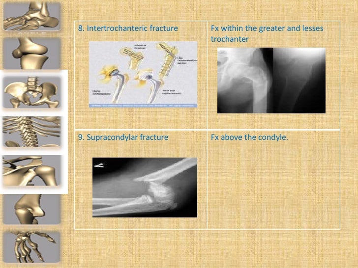 Ortho Hardware
