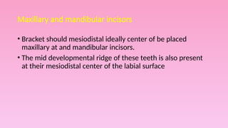 Mid Developmental Ridge PLACEMENT OF ORTHODOTIC BRACKET. pptx | PPTX