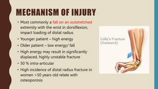 • Most commonly a fall on an outstretched
extremity with the wrist in dorsiflexion,
impact loading of distal radius
• Younger patient – high energy
• Older patient – low energy/ fall
• High energy may result in significantly
displaced, highly unstable fracture
• 50 % intra-articular
• High incidence of distal radius fracture in
women >50 years old relate with
osteoporosis
MECHANISM OF INJURY
 