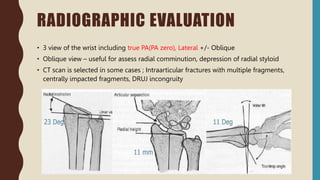 • 3 view of the wrist including true PA(PA zero), Lateral +/- Oblique
• Oblique view – useful for assess radial comminution, depression of radial styloid
• CT scan is selected in some cases ; Intraarticular fractures with multiple fragments,
centrally impacted fragments, DRUJ incongruity
RADIOGRAPHIC EVALUATION
 
