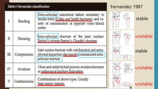 Fernandez 1987
unstable
unstable
stable
stable
unstable
 