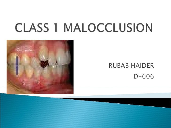 Class1 Malocclusion Ppt Class1 Malocclusion Ppt