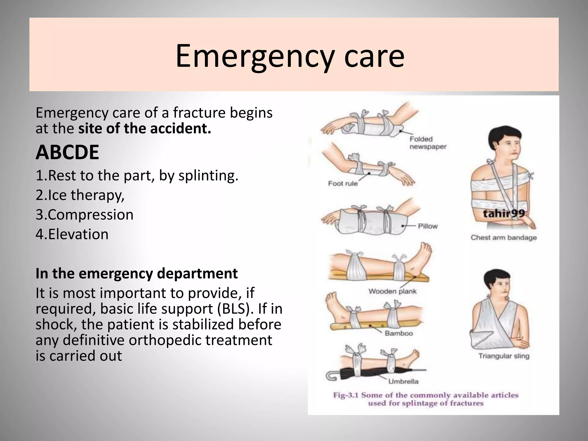 Emergency care
Emergency care of a fracture begins
at the site of the accident.
ABCDE
1.Rest to the part, by splinting.
2.Ice therapy,
3.Compression
4.Elevation
In the emergency department
It is most important to provide, if
required, basic life support (BLS). If in
shock, the patient is stabilized before
any definitive orthopedic treatment
is carried out
 