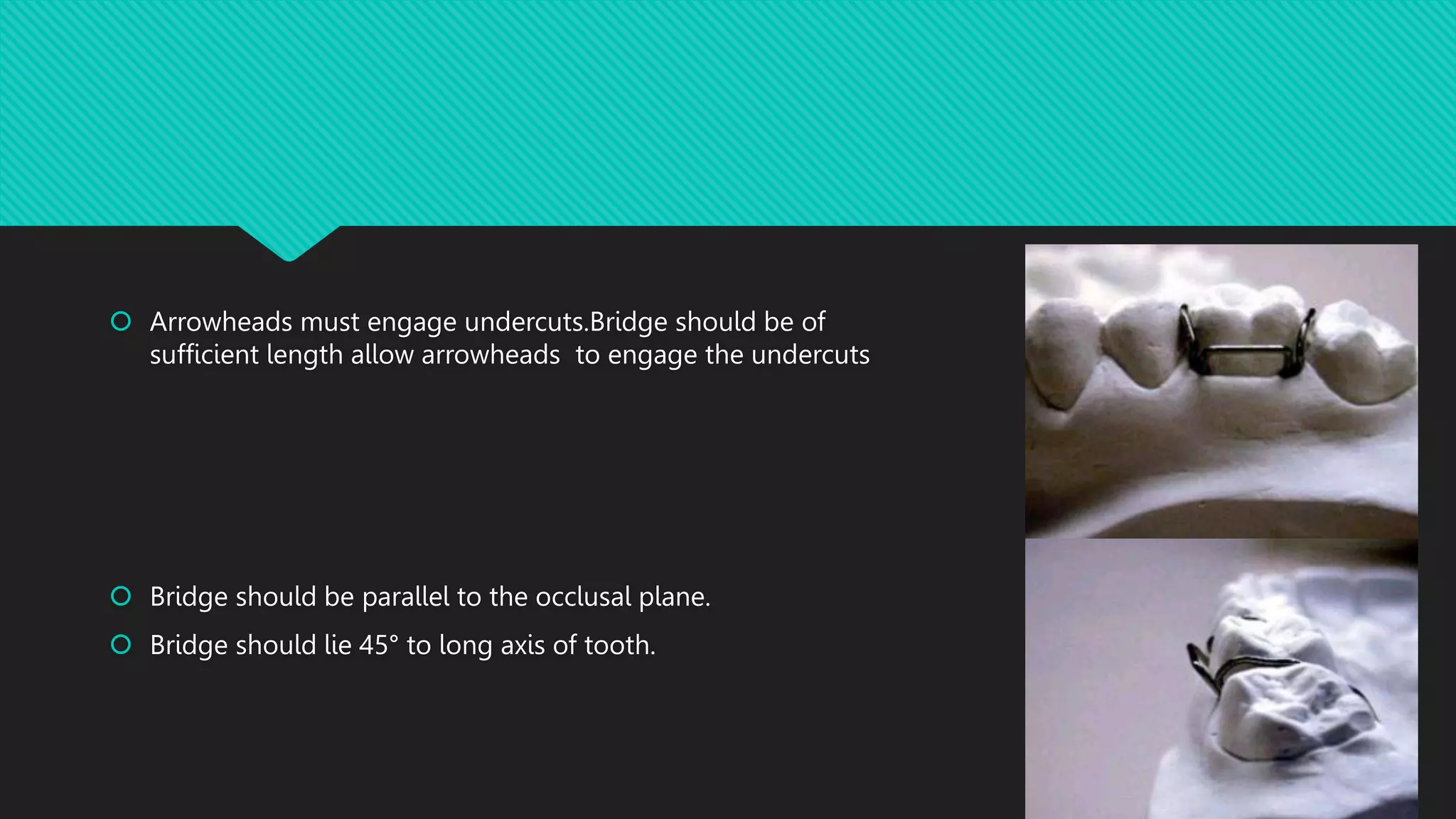 Adams clasp theory and fabrication PPT