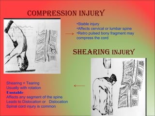 Sheering Injuries Ortho appns | PPT