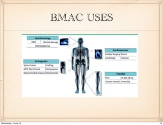 Orthobiologics - PRP, BMC the real story so far! | PDF